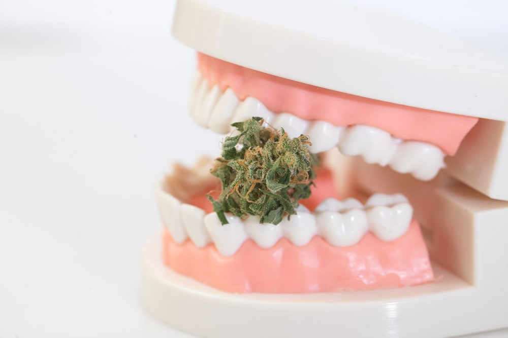 How to Consume Cannabis Without Getting Periodontal Disease